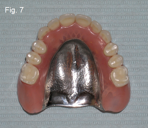 thumbnail interactive-video image 1 of 100 Pcs Gold Plated Dental Denture Mesh Strengthener - Laboratory Supplies 1 of 3