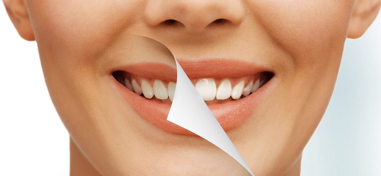 Cosmetic Dentistry