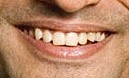 Cosmetic Dentistry For Male