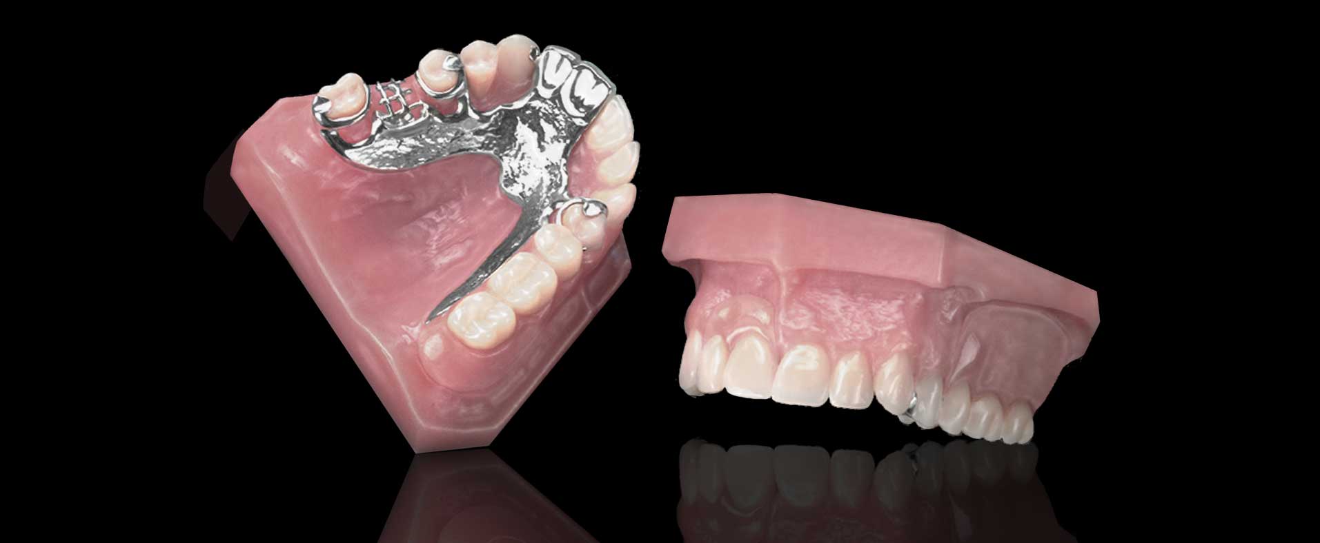 Partial Cast Dentures